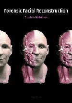 forensic facial reconstruction 1st edition caroline wilkinson 0521820030, 978-0521820035
