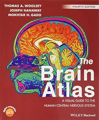 the brain atlas a visual guide to the human central nervous system 1st edition thomas a woolsey ,joseph