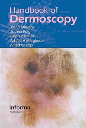 handbook of dermoscopy 1st edition josep malvehy ,ralph p braun ,ashfaq a marghoob ,alfred w kopf ,susana