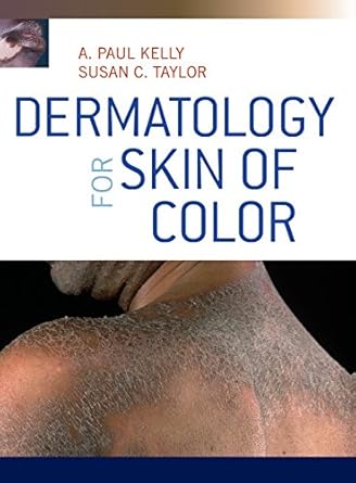 dermatology for skin of color 1st edition a paul kelly ,susan taylor 0071446710, 978-0071446716