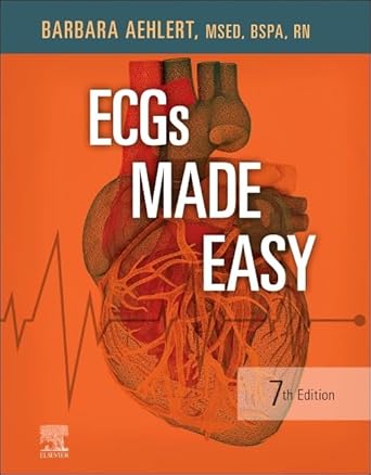 ecgs made easy 1st edition barbara j aehlert msed bspa rn 0323794254, 978-0323794251