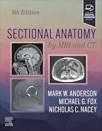 sectional anatomy by mri and ct 1st edition mark w anderson md ,michael g fox md ,nicholas c nacey md