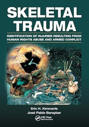 skeletal trauma identification of injuries resulting from human rights abuse and armed conflict 1st edition