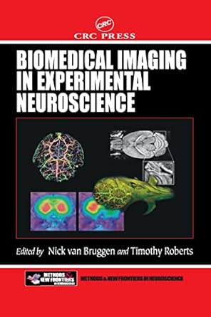 biomedical imaging in experimental neuroscience 1st edition nick van bruggen ,timothy p l roberts 084930122x,