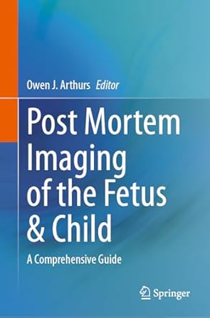 post mortem imaging of the fetus and child a comprehensive guide 1st edition owen arthurs 303169693x,