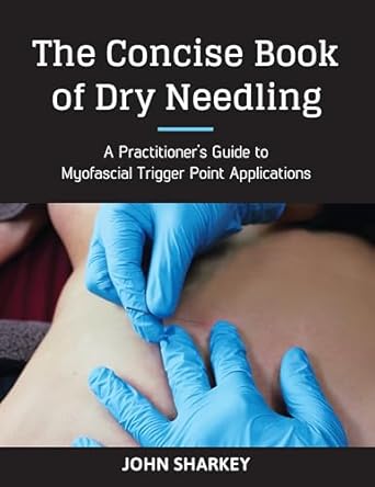 the concise book of dry needling a practitioners guide to myofascial trigger point applications 1st edition