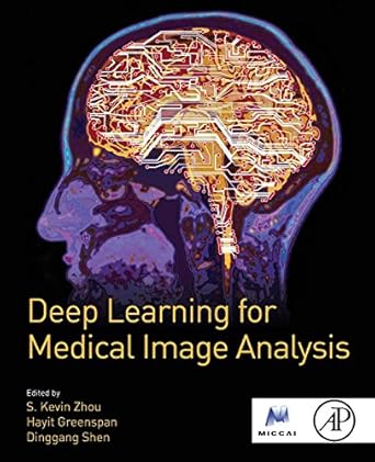 deep learning for medical image analysis 1st edition s kevin zhou ,hayit greenspan ,dinggang shen 0128104082,