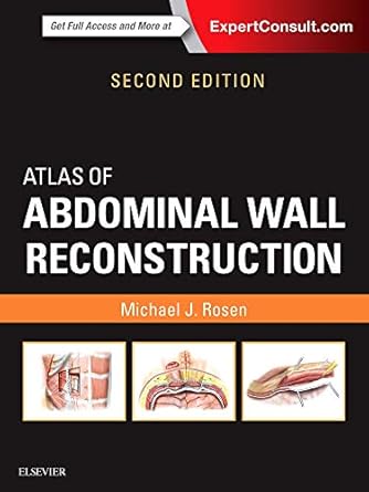 atlas of abdominal wall reconstruction expert consult online and print 1st edition michael j rosen md facs