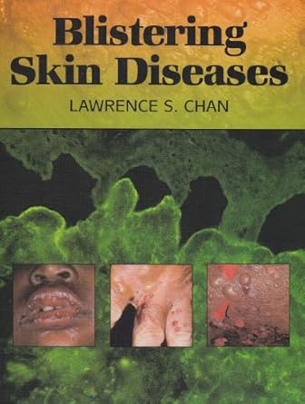 blistering skin diseases 1st edition lawrence s chan 1555815200, 978-1555815202