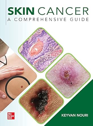 skin cancer a comprehensive guide 1st edition keyvan nouri 1260453006, 978-1260453003