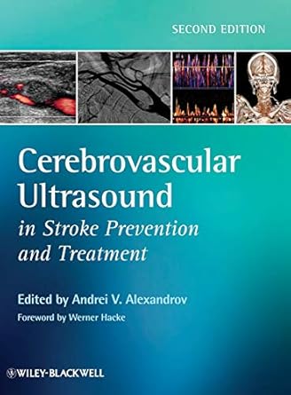 cerebrovascular ultrasound in stroke prevention and treatment 1st edition andrei v alexandrov ,werner hacke