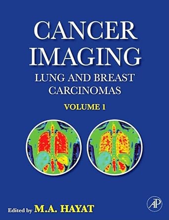 cancer imaging lung and breast carcinomas 1st edition m a hayat 0123704685, 978-0123704689