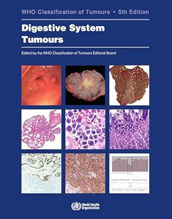 digestive system tumours who classification of tumours 1st edition who classification of tumours editorial