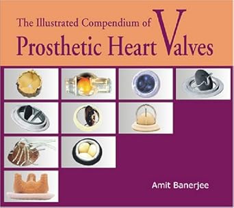 the illustrated compendium of prosthetic heart valves 1st edition amit banerjee 8171883346, 978-8171883349