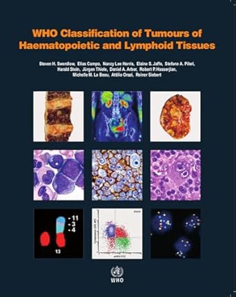 who classification of tumours of haematopoietic and lymphoid tissues op 1st edition who classification of