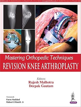 revision knee arthroplasty 1st edition rajesh malhotra ,deepak gautam ,fares haddad ,jr booth, robert e