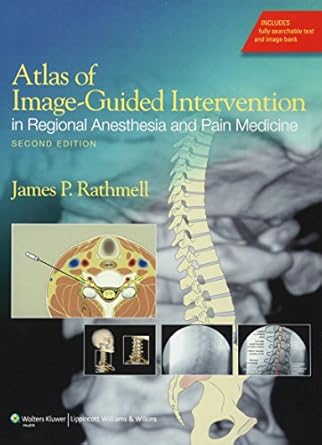 atlas of image guided intervention in regional anesthesia and pain medicine 1st edition james p rathmell md