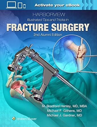harborview illustrated tips and tricks in fracture surgery 1st edition m henley md 1496355989, 978-1496355980