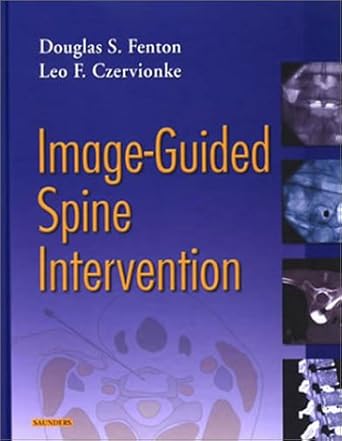 image guided spine intervention 1st edition douglas s fenton ,leo f czervionke 0721600212, 978-0721600215