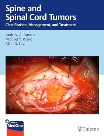 spine and spinal cord tumors classification management and treatment 1st edition andrew fanous ,michael wang