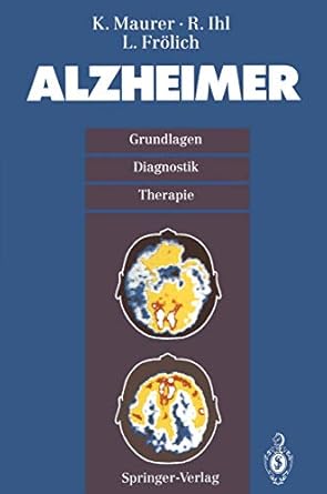 alzheimer grundlagen diganostik therapie 1st edition k maurer ,r ihl ,l frolich 3540569324, 978-3540569329
