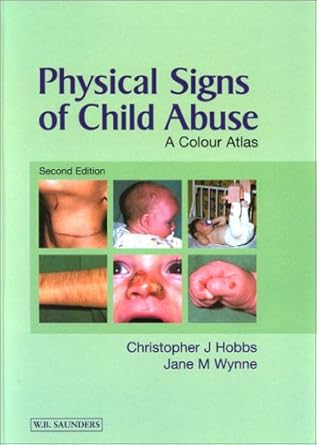 physical signs of child abuse 1st edition christopher j hobbs bsc mb bs frcp dobstrcog frcpch ,jane m wynne