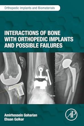 interactions of bone with orthopedic implants and possible failures 1st edition amirhossein goharian ,ehsan