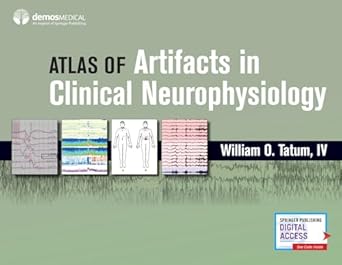 atlas of artifacts in clinical neurophysiology 1st edition william o tatum iv do 0826169341, 978-0826169341