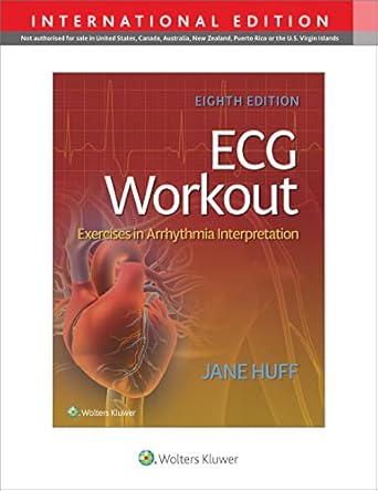 ecg workout exercises in arrythmia interpretation 1st edition jane huff 1975174577, 978-1975174576