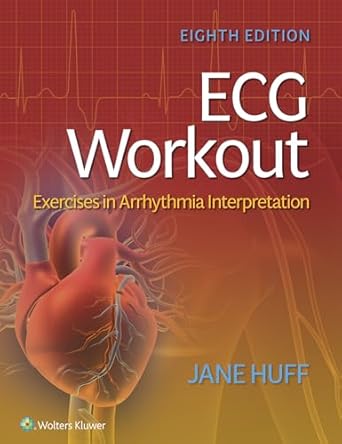 ecg workout exercises in arrhythmia interpretation 1st edition loreda j huff 1975174542, 978-1975174545