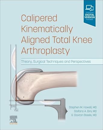 calipered kinematically aligned total knee arthroplasty theory surgical techniques and perspectives 1st