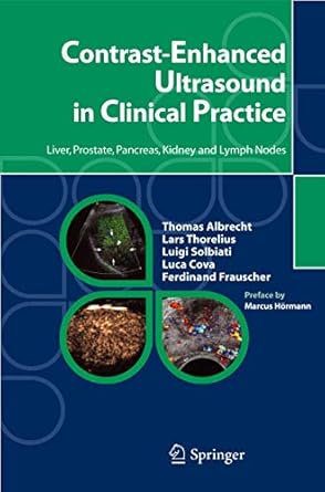 contrast enhanced ultrasound in clinical practice liver prostate pancreas kidney and lymph nodes 1st edition