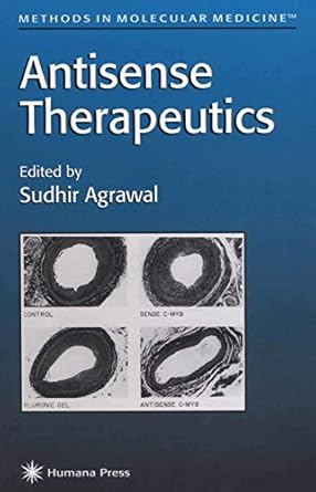 antisense therapeutics 1st edition agarwal sudhir 0896033058, 978-0896033054