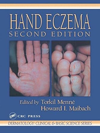 hand eczema 1st edition torkil menne ,howard i maibach 0849373557, 978-0849373558