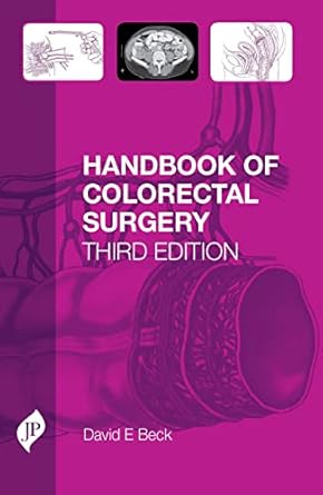 handbook of colorectal surgery 1st edition david beck 1907816208, 978-1907816208