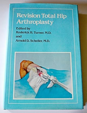 revision total hip arthroplasty 1st edition roderick h turner ,arnold d scheller 0808914669, 978-0808914662
