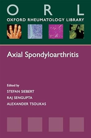 axial spondyloarthritis 1st edition siebert ,sengupta ,tsoukas 0198755295, 978-0198755296