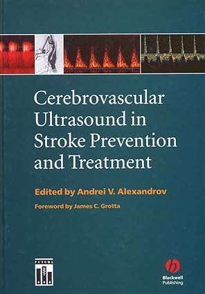 cerebrovascular ultrasound in stroke prevention and treatment 1st edition andrei v alexandrov ,james c grotta