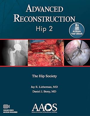 advanced reconstruction hip 2 print + ebook with multimedia 1st edition jay r lieberman m d ,daniel j berry m
