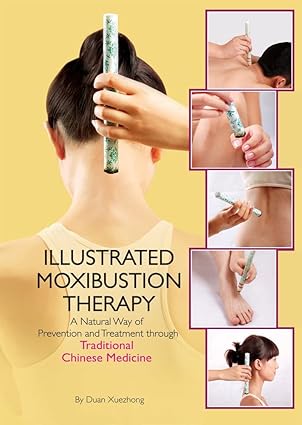 illustrated moxibustion therapy a natural way of prevention and treatment through traditional chinese