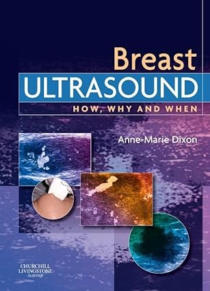 breast ultrasound how why and when 1st edition anne marie dixon mhsc pgchep dmu dcrr 0443100764,