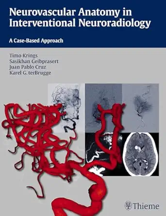 neurovascular anatomy in interventional neuroradiology a case based approach 1st edition timo krings