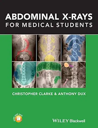 abdominal x rays for medical students 1st edition christopher clarke ,anthony dux 111860055x, 978-1118600559
