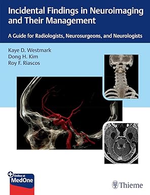 incidental findings in neuroimaging and their management a guide for radiologists neurosurgeons and