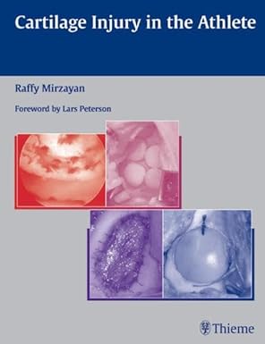 cartilage injury in the athlete 1st edition raffy mirzayan 1588903052, 978-1588903051