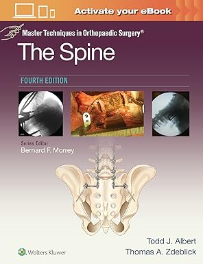 master techniques in orthopaedic surgery the spine 1st edition todd albert md ,thomas a zdeblick md