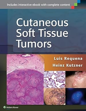 cutaneous soft tissue tumors 1st edition luis requena ,heinz kutzner md 1451192762, 978-1451192766