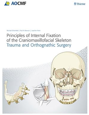 principles of internal fixation of the craniomaxillofacial skeleton trauma and orthognathic surgery 1st