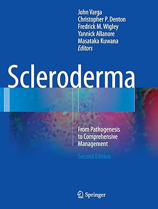 scleroderma from pathogenesis to comprehensive management 1st edition john varga ,christopher p denton