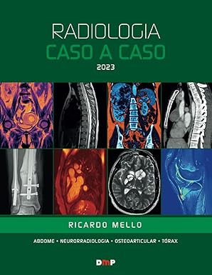 radiologia caso a caso 2023 1st edition prof ricardo mello 6598166802, 978-6598166809